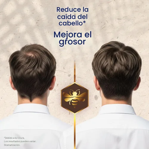 Vista 4 de TIO NACHO Acondicionador Engrosador Aumento de Volumen- Anticaída 14 Onzas Líquidas Hair Loss Conditioner for Men and Women, Volumizing Formula
