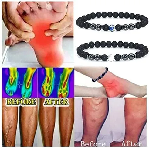 Vista 3 de INENIMARTJ Tobillera de obsidiana negra antihinchazón para hombres y mujeres, tobillera de hematita, tobillera de obsidiana negra para hinchazón