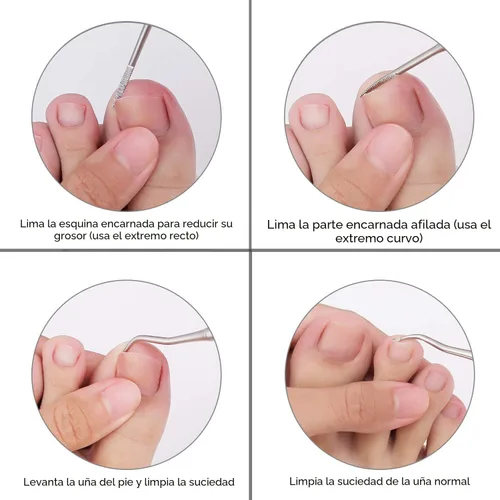 Vista 6 de YINYIN, 2 limas de uñas encarnadas y levantador con estuche de almacenamiento, herramienta de uñas encarnadas de acero inoxidable 100%, herramienta