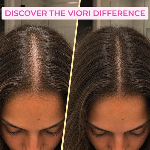 Vista 5 de Viori Coconut Advanced Repair barra sin aroma de champú y acondicionador – agua de arroz Longsheng y ésteres de jojoba – sin sulfatos, ecológico