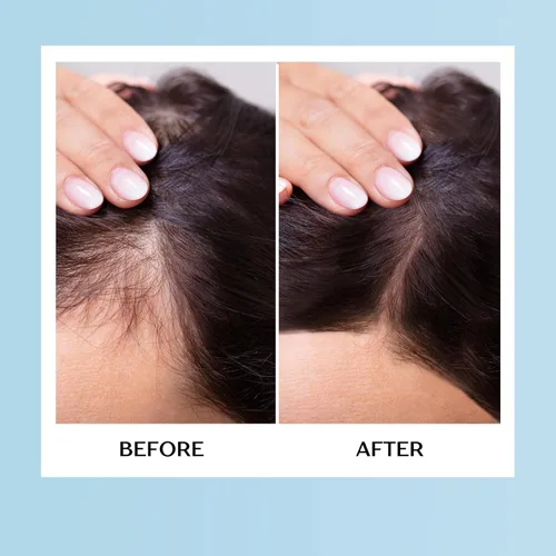 Vista 5 de Therapro Mediceuticals Suplemento de ganancia de cabello para hombres y mujeres - 60 tabletas