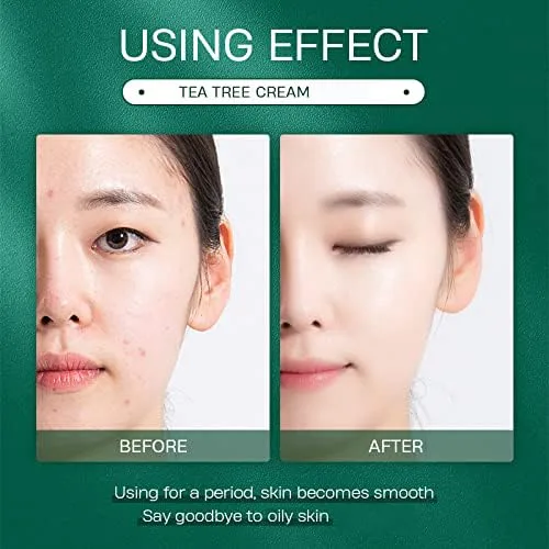 Vista 6 de AKARY Crema facial con aceite de árbol de té para piel grasa, hidratante facial extra calmante y nutritiva, no grasa, reparación suave para piel