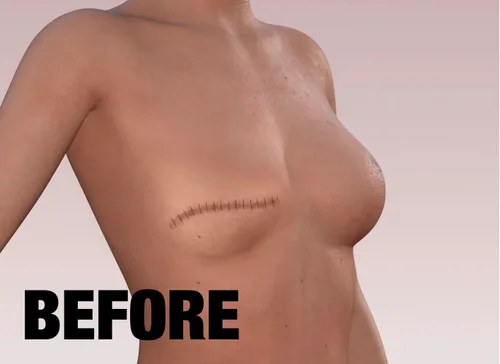 Vista 3 de Tatuaje temporal de rosa para cicatrices – Tatuaje realista impermeable de cubierta de cicatrices para mastectomía, reconstrucción y cirugía