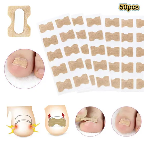Vista 2 de Parche de corrección de uñas encarnadas, 50 calcomanías de uñas encarnadas sin pegamento para uñas encarnadas curvadas para el cuidado de los pies