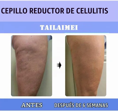 Vista 3 de TailaiMei Cepillo masajeador anticelulítico, limpiador de ducha corporal para removedor de celulitis, mejora la circulación, fascia, cepillo