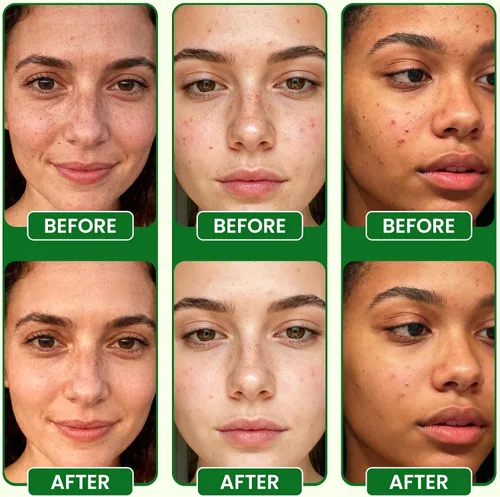 Vista 5 de Lukaree Suero de vitamina C para la cara – Suero facial de vitamina C iluminador con hialuronato de sodio Unifica el tono de la piel y suaviza