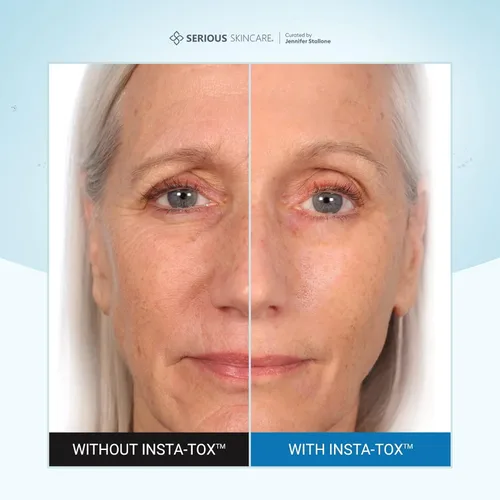 Vista 2 de Serious Skincare INSTA-TOX Suero Instantáneo Alisador de Arrugas - Relleno Facial Mejora la Apariencia de Líneas, Poros y Arrugas Profundas - Tensor