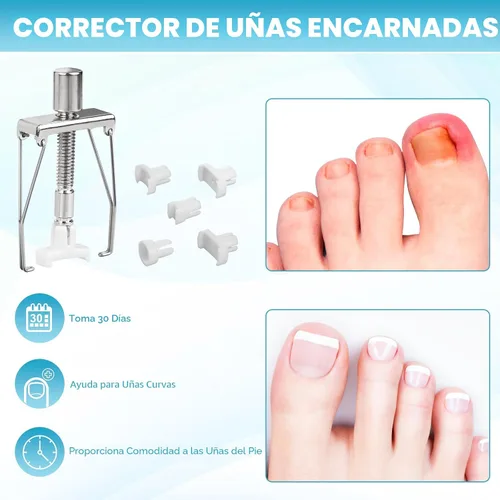 Vista 6 de Kit Profesional para Retirar Uñas Encarnadas, Incluye Gotas Correctoras de Uñas Encarnadas, Parche Corrector, Cortauñas, Lima de Uñas, Herramientas