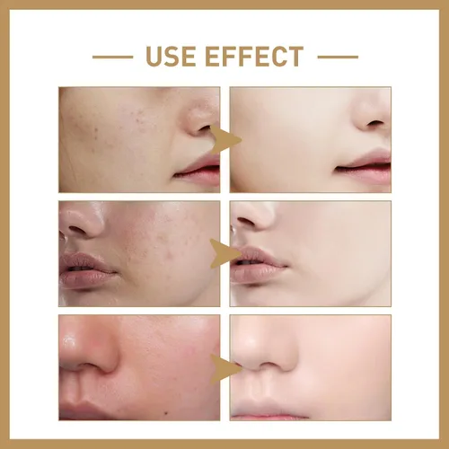 Vista 6 de Crema de Arroz Para La Cara, Crema Para Manchas Oscuras En La Cara, Crema Para Cerrar Poros Abiertos Cara, Cremas Productos Coreanas Para La Cara