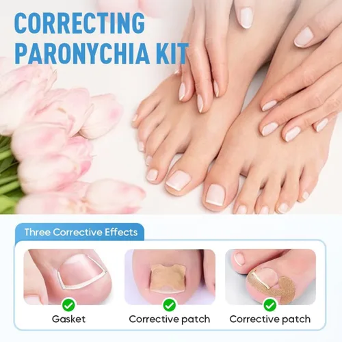 Vista 3 de Juego profesional de uñas encarnadas con tiras transpirables de uñas encarnadas, parche corrector de uñas curvas, kit de herramientas de pedicura