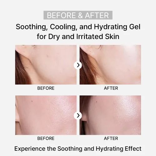 Vista 8 de ARZTIN Rejuvenation Pflege Gel, gel suavizante facial y corporal, gel no pegajoso, After Sun con aloe, agua mineral, 4.4 onzas líquidas