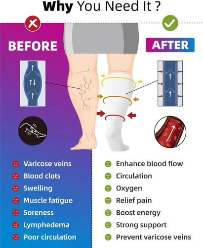 Vista 3 de Paquete de 3 calcetines de compresión de talla grande para mujeres y hombres, medias altas hasta la rodilla de 20-30 mmHg para piernas grandes e