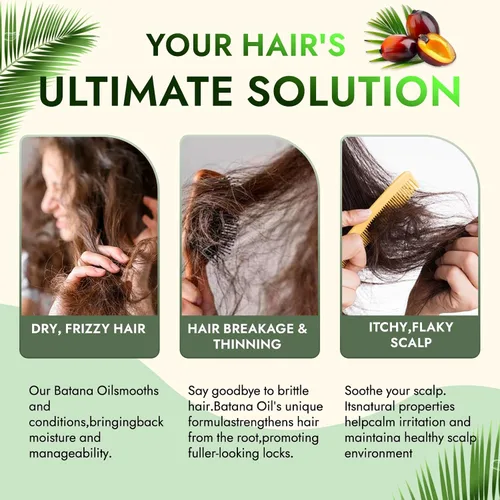 Vista 3 de Batana - Aceite para el crecimiento del cabello prensado en frío para engrosar y fortalecer el cabello con aceite de romero y ricino, tratamiento