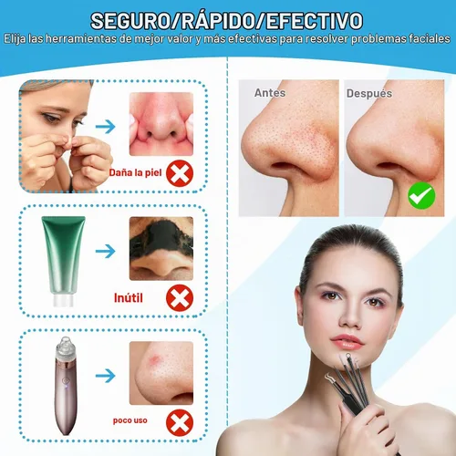 Vista 2 de Herramientas Removedoras de Puntos Negros Kit de Herramientas para Reventar Espinillas, Extractor de Comedones Kit de Eliminación de Acné