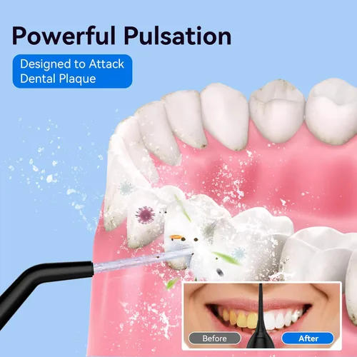 Vista 3 de Irrigador de agua portátil inalámbrico con tanque de 10.1 fl oz: irrigador oral recargable con 5 puntas para viajes, cuidado de frenillos y encías