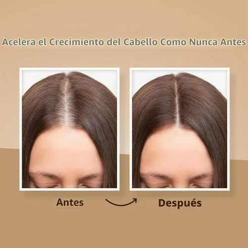 Vista 5 de Herbishh Champú y acondicionador espesante Vitalizador capilar Aceite de esencia para el crecimiento del cabello Previene la pérdida