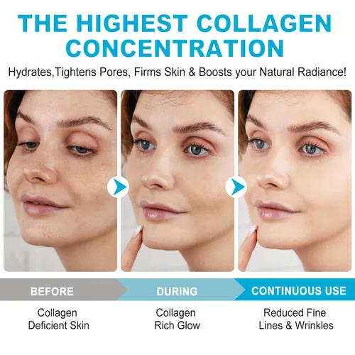 Vista 5 de Máscara profunda real de bio-colágeno, máscara facial de colágeno, máscara de colágeno para mujeres con ácido hialurónico, máscaras faciales