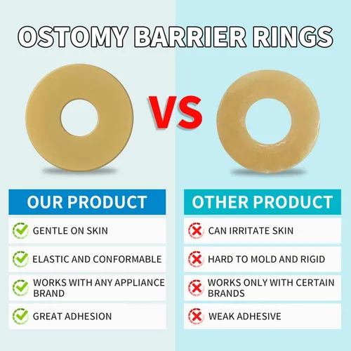 Vista 5 de Anillos de barrera para ostomía, anillos de ostomía moldeables sin picaduras, anillos extensores de piel hidrocoloides para bolsas de colostomía
