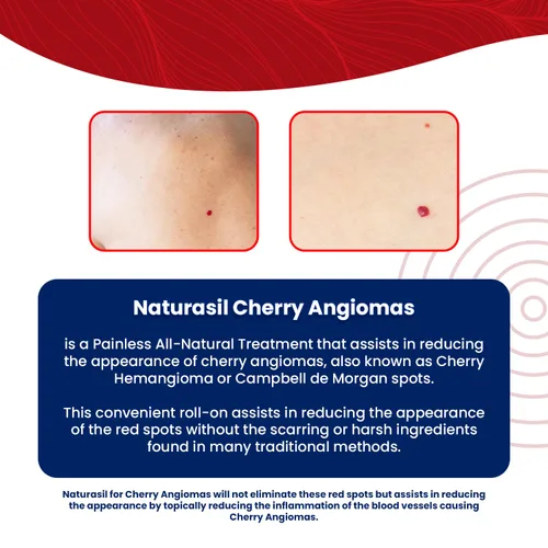 Vista 3 de Naturasil Cherry Angiomas 0.3 fl oz Liquid Roller