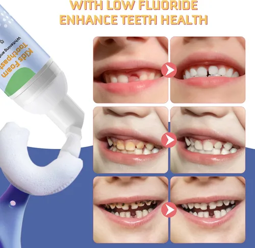 Vista 6 de Pasta de dientes de espuma para niños, 4 paquetes de pasta de dientes de espuma para cepillo de dientes eléctrico en forma de U, pasta de dientes