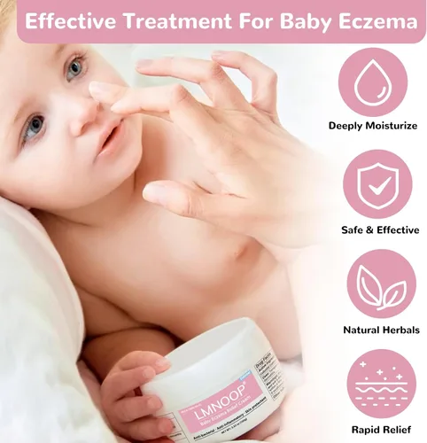 Vista 3 de Crema para aliviar el eccema del bebé, fórmula herbaria totalmente natural para una protección segura y calmante de la piel contra erupciones