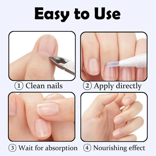 Vista 5 de Bolígrafo de reparación de uñas, hongo en las uñas de los pies, extra fuerte, reparación y renovación de uñas decoloradas, dañadas, rotas y gruesas