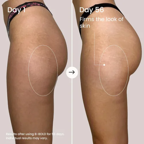 Vista 4 de MAËLYS B-BOLD - Mascarilla para realzar los glúteos, crema corporal reafirmante y reafirmante para la zona del trasero, tensar la piel con ácido