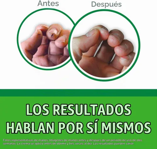 Vista 2 de O'Keeffe's K0680001-3 Working Hands Crema de manos en tarro (paquete de 3), 6.8 oz