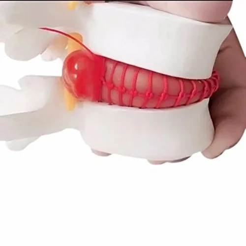 Vista 3 de DENTAL Color blanco oral 1:1.5 vértebras lumbares humanas anatómicas degenerativas lumbares modelo de columna vertebral humana US Stock