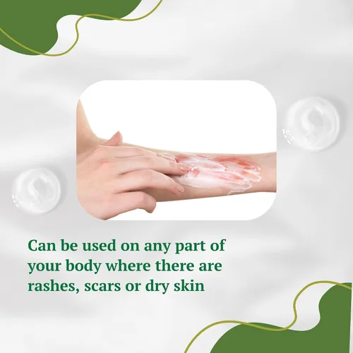 Vista 5 de Crema de aloe vera, corrige marcas oscuras, piel seca y nuevas cicatrices en el cuerpo, crema facial para imperfecciones, reduce la apariencia