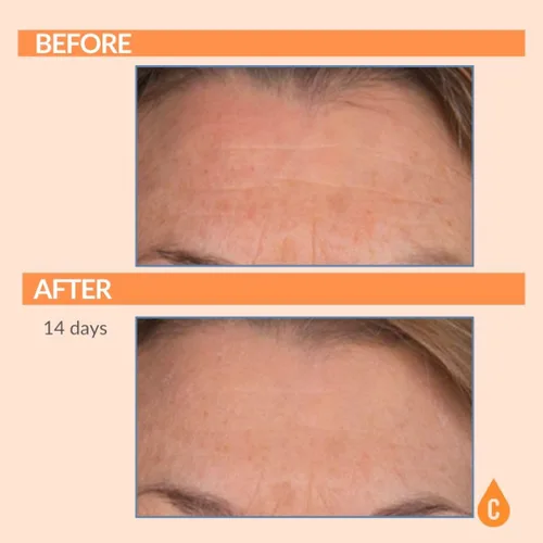 Vista 4 de Serious Skincare Suero de vitamina C para cara, suero facial antienvejecimiento con colágeno, vitamina E, cuidado hidratante de la piel