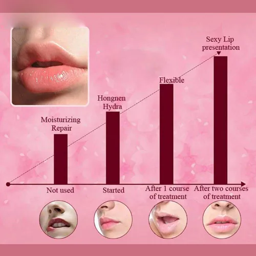 Vista 3 de Parches de máscara de labios, 30 almohadillas de gel de colágeno de cristal rosa, hidratante, antiarrugas, antienvejecimiento, firme, hidratan