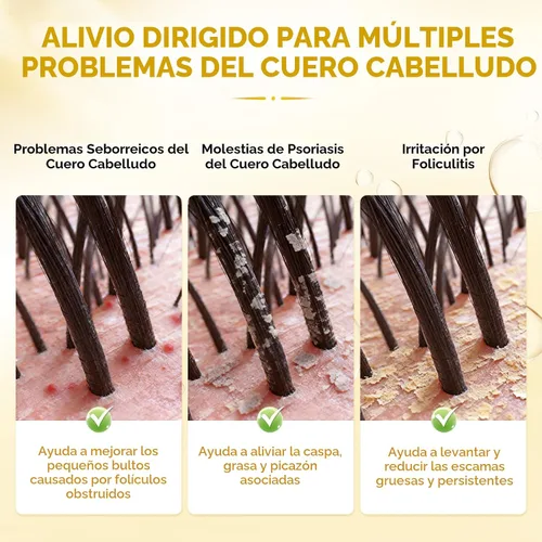 Vista 5 de Champú antifúngico mejorado para dermatitis seborreica, foliculitis y psoriasis del cuero cabelludo, champú anticaspa para hombres y mujeres, alivia