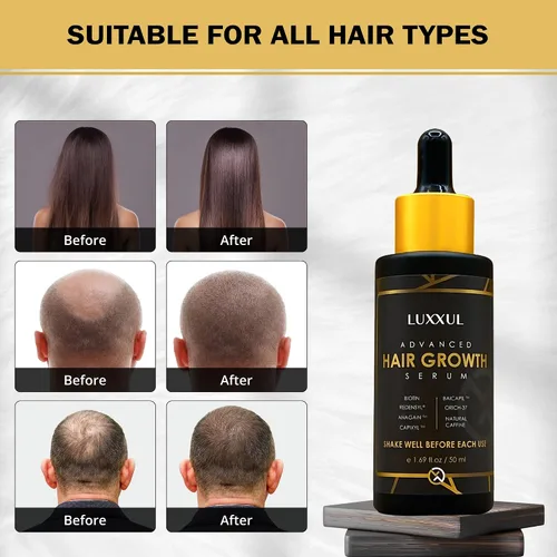 Vista 8 de LUXXUL Suero de apoyo para el crecimiento del cabello, 1.7 fl oz - Suero natural activo Redensyl para cabello más saludable, más grueso y lleno