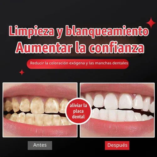 Vista 6 de SP-6 Pasta dental blanqueadora probiótica – Fórmula avanzada con 6 probióticos para blanqueamiento dental y salud de las encías, sin flúor, segura
