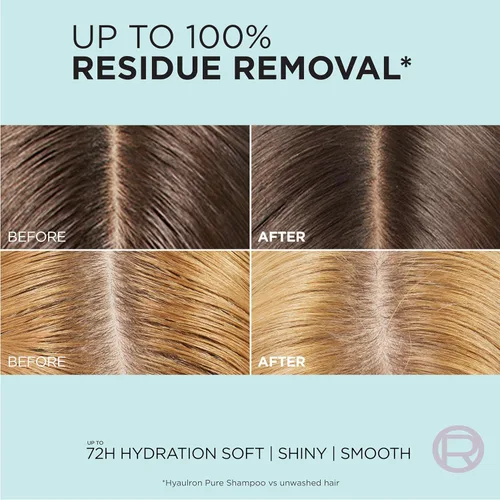 Vista 5 de L'Oreal Paris Elvive Hyaluron + Pure 72H Acondicionador rehidratante para cabello graso, acondicionador para cabello con ácido salicílico y ácido