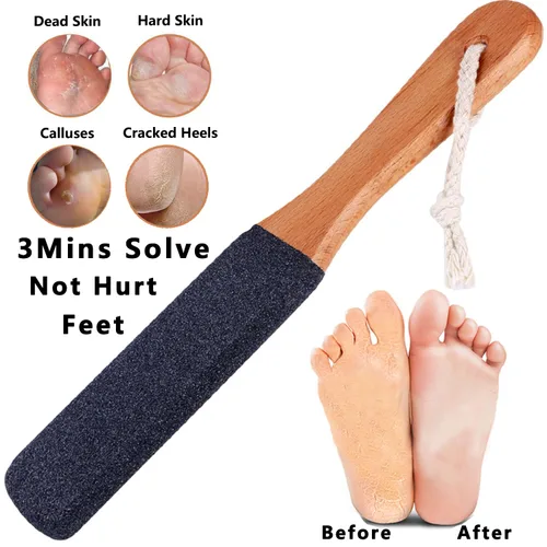 Vista 2 de LEKESI - Lima de piedra pómez para retirar callosidades y piel muerta de los pies, herramienta para exfoliar y masajear los pies, se usa con pies
