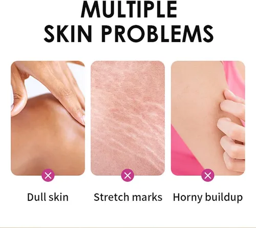 Vista 6 de Aceite de pelado amarillo, aceite de pelado fuerte para piel oscura, extra fuerte, solución exfoliante para el cuerpo, todo tipo de piel, removedor