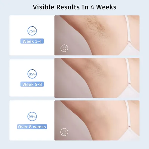 Vista 4 de Depilación láser, depilación láser para mujeres, 9999999 Flashes, dispositivo de depilación, depilación láser IPL para piernas faciales, brazos, uso