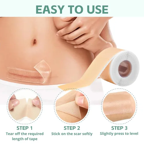 Vista 6 de Hojas de silicona para cicatrices, cinta de silicona para cicatrices quirúrgicas, impermeable, reutilizable, eliminación de cicatrices, rollo