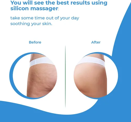 Vista 7 de Rodillo masajeador anticelulítico para eliminar la celulitis, mejora el flujo sanguíneo, cepillo para celulitis y rodillo para celulitis con crema