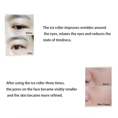 Vista 6 de Paquete de 5 rodillos de hielo para herramientas de cuidado de la piel facial, masaje corporal, alivio del dolor, hinchazón, rodillo facial Verde