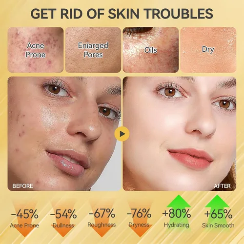 Vista 4 de Set de cuidado de la piel, juegos y kits revitalizantes para el cuidado de la piel de caracol facial, regalos para niñas adolescentes con limpiador