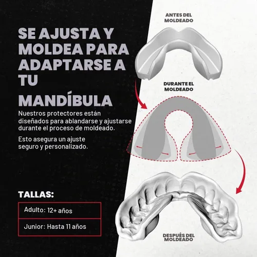 Vista 2 de SAFEJAWZ Protector bucal negro para aparatos ortopédicos, protector bucal