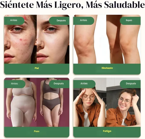 Vista 2 de Migcopat Gotas liposomales de drenaje linfático 26 en 1, con equinácea, cúrcuma, saúco, diente de león, vitaminas y verbascum para pulmones, sistema