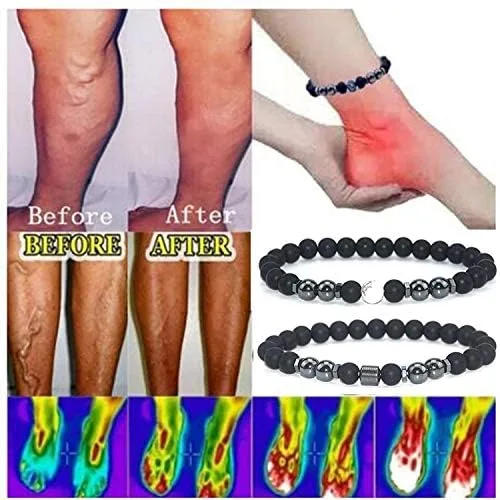 Vista 2 de INENIMARTJ Tobillera de obsidiana negra antihinchazón para hombres y mujeres, tobillera de hematita, tobillera de obsidiana negra para hinchazón