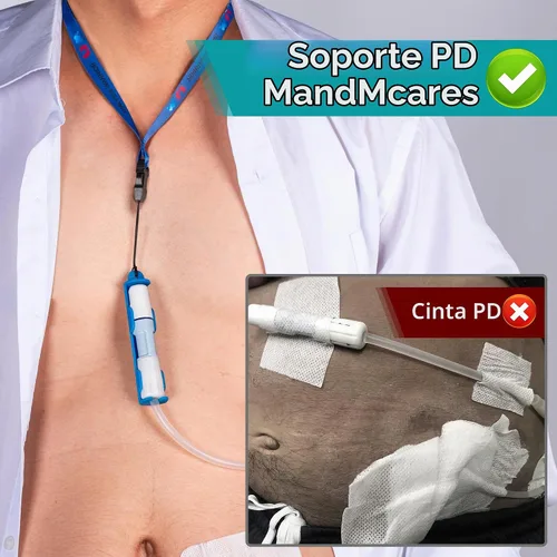 Vista 2 de Soporte patentado de transferencia de diálisis peritoneal para Baxter, accesorios para cinturón de soporte de catéter PD Azul