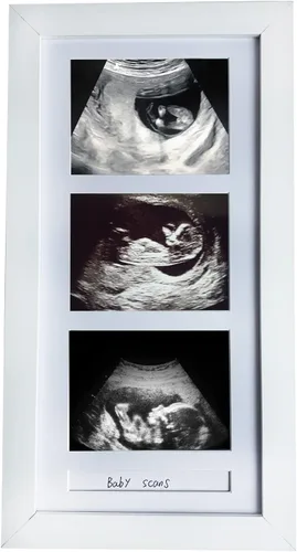 Vista 7 de Marcos de fotos de ultrasonido triple, marco de fotos de sonograma, 3 fotos, anuncios de embarazo, regalos de embarazo para madres primerizas, Negro