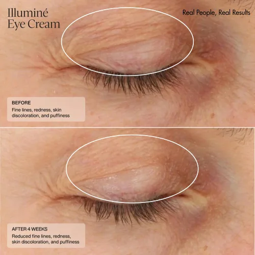 Vista 5 de Senté Illuminé - Crema de ojos para disminuir las ojeras, la decoloración, el enrojecimiento y la hinchazón alrededor de los ojos, con HSA