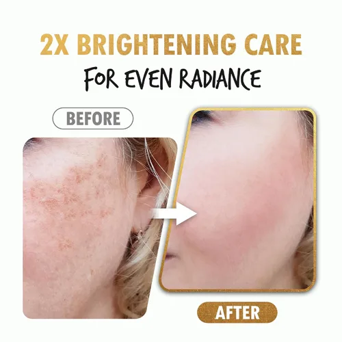 Vista 5 de Sérum iluminador Suero iluminador de la piel para la cara Suero hidratante facial orgánico de hiperpigmentación Suero facial hidratante